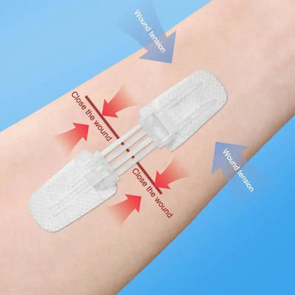 Zipper Band Aid Painless Wound Closure Patch Suture Free Waterproof Bandage First Aid Supplies for Camping and Hiking